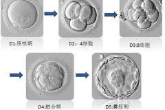 广州助孕过程中移植是关键的一步